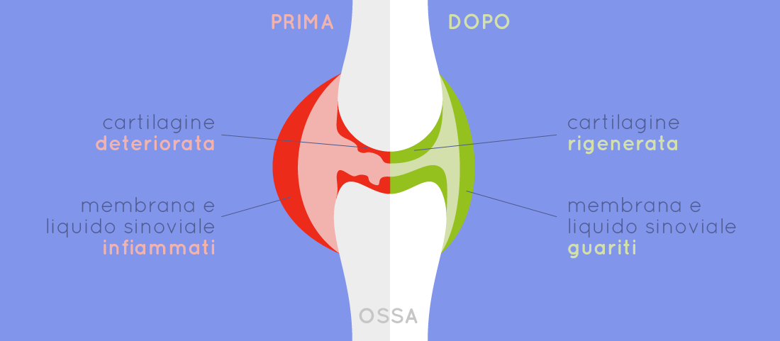 Articolazione sana e malata